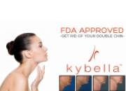 Kybella